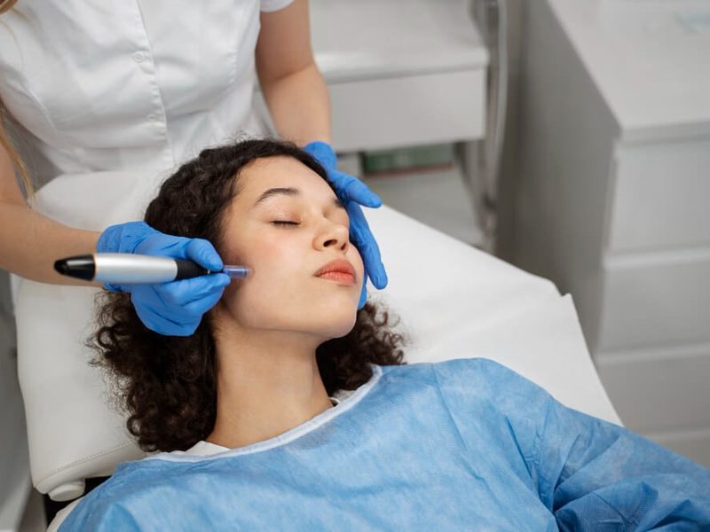 Esthetician performing a microneedling treatment on a client’s face